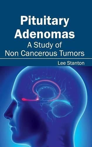 Cover image for Pituitary Adenomas: A Study of Non Cancerous Tumors