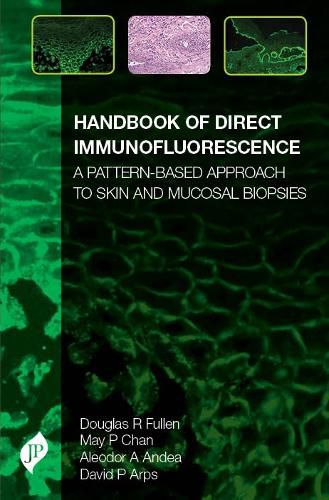 Cover image for Handbook of Direct Immunofluorescence: A Pattern-Based Approach to Skin and Mucosal Biopsies