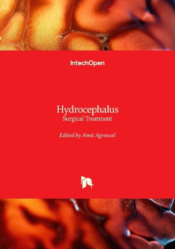 Cover image for Hydrocephalus