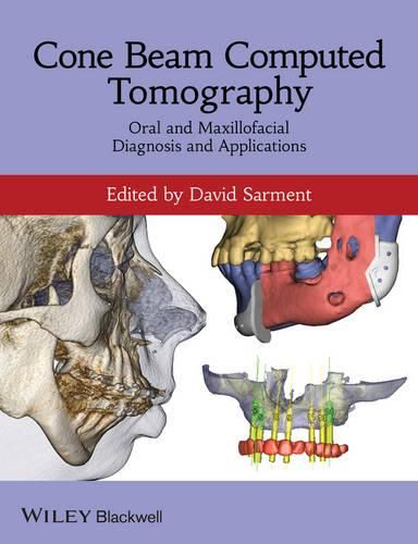 Cover image for Cone Beam Computed Tomography - Oral and Maxillofacial Diagnosis and Applications