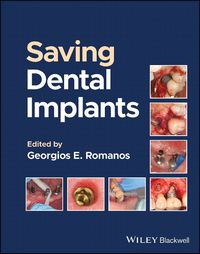 Cover image for Saving Dental Implants