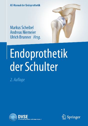 Cover image for Endoprothetik der Schulter