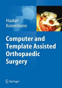 Cover image for Computer and Template Assisted Orthopedic Surgery