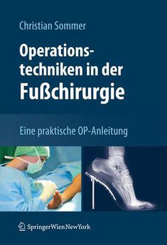 Cover image for Operationstechniken in der Fusschirurgie: Eine praktische OP-Anleitung