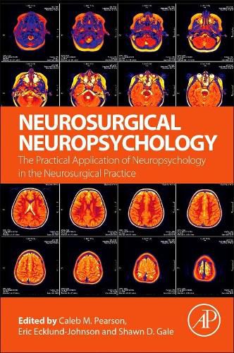 Neurosurgical Neuropsychology: The Practical Application of Neuropsychology in the Neurosurgical Practice