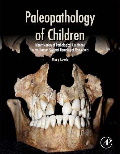 Cover image for Paleopathology of Children: Identification of Pathological Conditions in the Human Skeletal Remains of Non-Adults