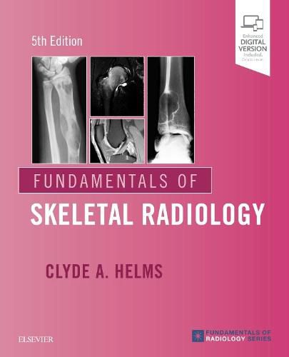 Cover image for Fundamentals of Skeletal Radiology