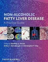 Cover image for Non-Alcoholic Fatty Liver Disease: A Practical Guide