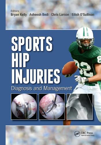 Sports Hip Injuries: Diagnosis and Management