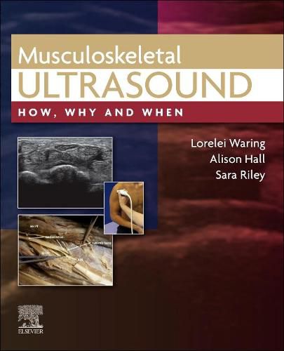 Cover image for Musculoskeletal Ultrasound: How, Why and When