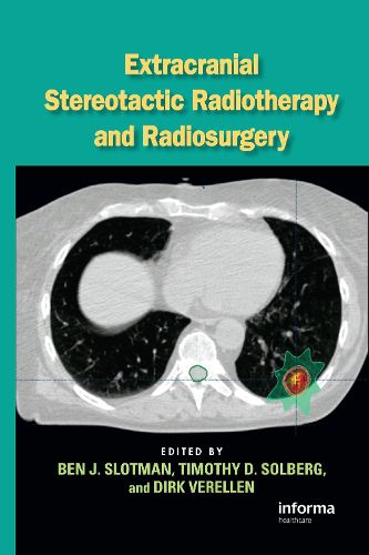 Cover image for Extracranial Stereotactic Radiotherapy and Radiosurgery