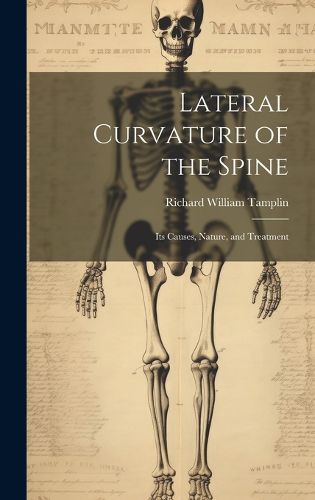 Cover image for Lateral Curvature of the Spine