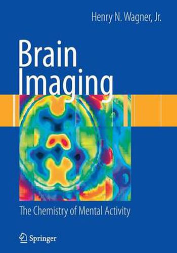 Cover image for Brain Imaging: The Chemistry of Mental Activity