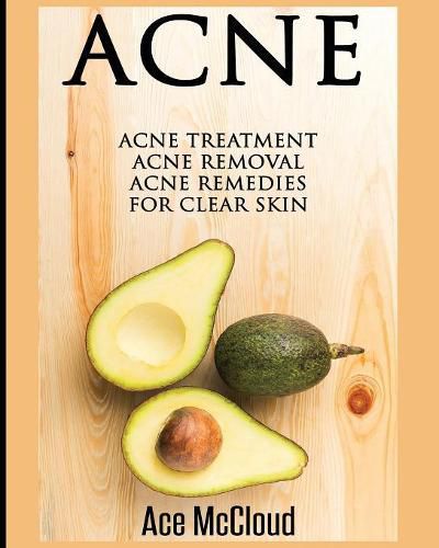 Cover image for Acne: Acne Treatment: Acne Removal: Acne Remedies For Clear Skin