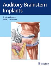 Cover image for Auditory Brainstem Implants