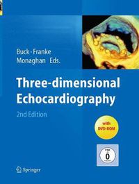 Cover image for Three-dimensional Echocardiography