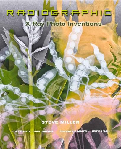 Radiographic: X-Ray Photo Inventions