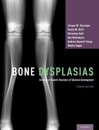 Cover image for Bone Dysplasias: An Atlas of Genetic Disorders of Skeletal Development