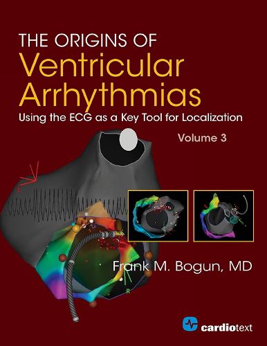 The Origins of Ventricular Arrhythmias, Volume 3