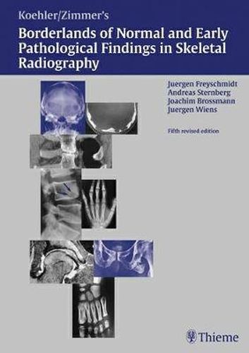 Freyschmidt's  Koehler/Zimmer  Borderlands of Normal and Early Pathological Findings in Skeletal Radiography