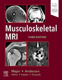 Cover image for Musculoskeletal MRI