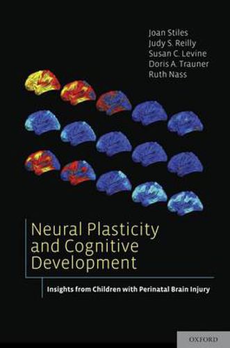 Cover image for Neural Plasticity and Cognitive Development: Insights from Children with Perinatal Brain Injury