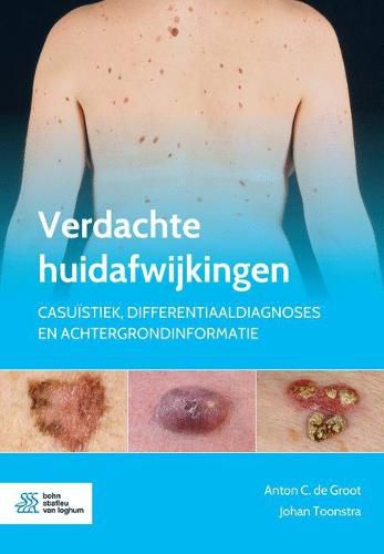 Verdachte Huidafwijkingen: Casuistiek, Differentiaaldiagnoses En Achtergrondinformatie