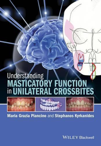 Cover image for Understanding Masticatory Function in Unilateral Crossbites