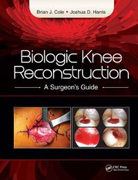 Cover image for Biologic Knee Reconstruction: A Surgeon's Guide