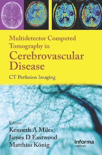 Cover image for Multidetector Computed Tomography in Cerebrovascular Disease: CT Perfusion Imaging