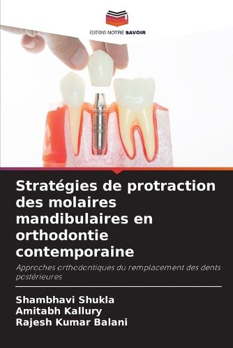 Cover image for Strategies de protraction des molaires mandibulaires en orthodontie contemporaine