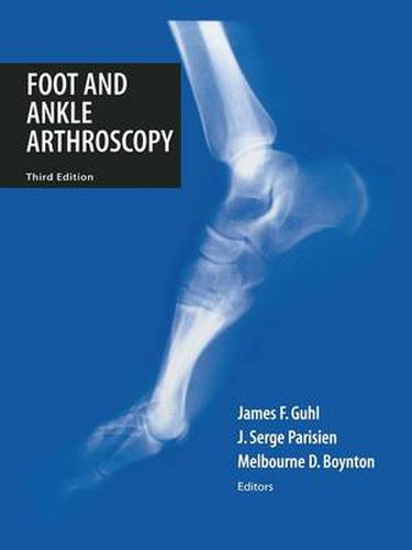 Cover image for Foot and Ankle Arthroscopy