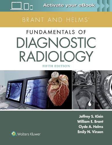 Cover image for Brant and Helms' Fundamentals of Diagnostic Radiology