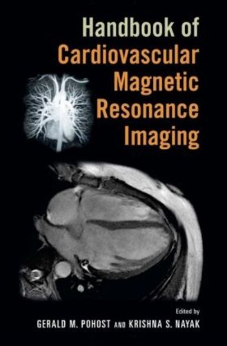 Cover image for Handbook of Cardiovascular Magnetic Resonance Imaging