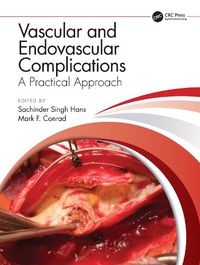 Cover image for Vascular and Endovascular Complications: A Practical Approach