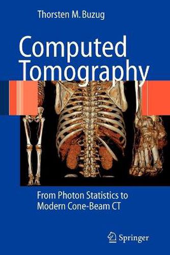 Cover image for Computed Tomography: From Photon Statistics to Modern Cone-Beam CT