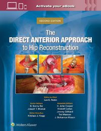 Cover image for The Direct Anterior Approach to Hip Reconstruction