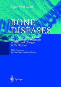 Cover image for Bone Diseases: Macroscopic, Histological, and Radiological Diagnosis of Structural Changes in the Skeleton