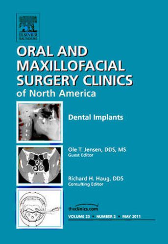 Cover image for Dental Implants, An Issue of Oral and Maxillofacial Surgery Clinics