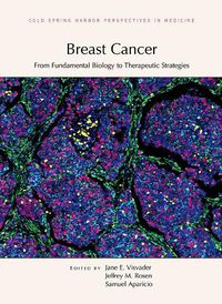 Cover image for Breast Cancer: From Fundamental Biology to Therapeutic Strategies