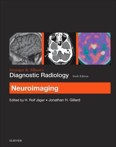 Cover image for Grainger & Allison's Diagnostic Radiology: Neuroimaging