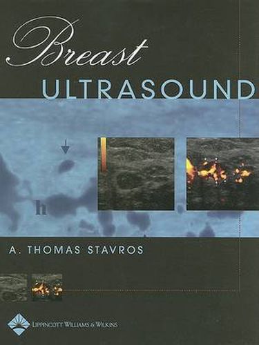 Cover image for Breast Ultrasound
