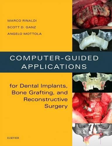 Cover image for Computer-Guided Applications for Dental Implants, Bone Grafting, and Reconstructive Surgery (adapted translation)