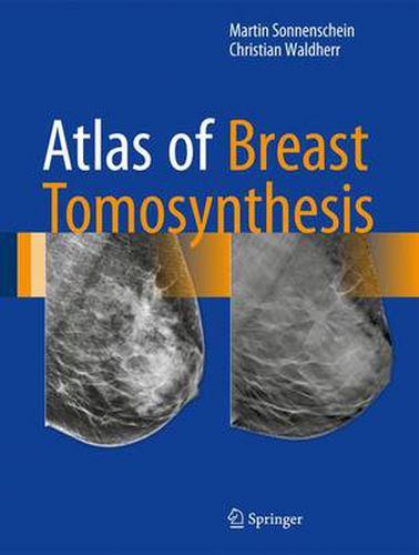 Cover image for Atlas of Breast Tomosynthesis: Imaging Findings and Image-Guided Interventions