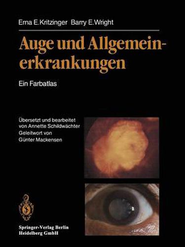 Cover image for Auge und Allgemeinerkrankungen: Ein Farbatlas