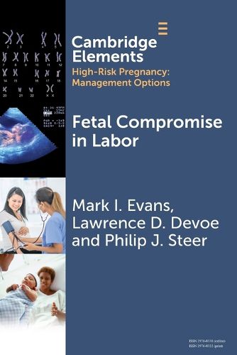 Cover image for Fetal Compromise in Labor