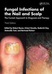 Cover image for Fungal Infections of the Nail and Scalp