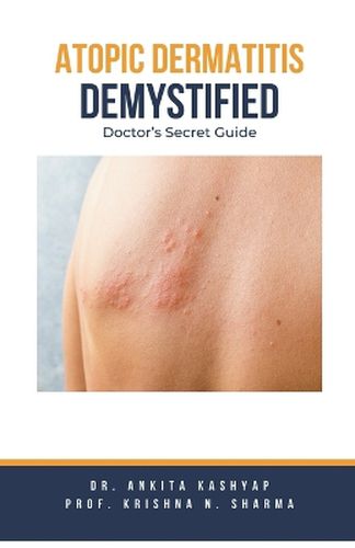 Cover image for Atopic Dermatitis Demystified