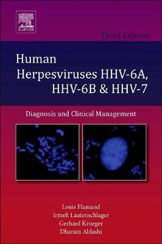 Cover image for Human Herpesviruses HHV-6A, HHV-6B and HHV-7: Diagnosis and Clinical Management