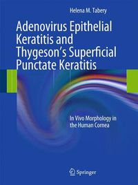 Cover image for Adenovirus Epithelial Keratitis and Thygeson's Superficial Punctate Keratitis: In Vivo Morphology in the Human Cornea